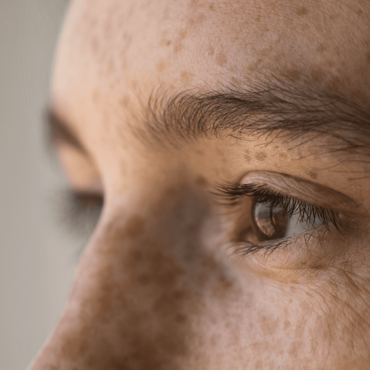 Close-up of a person's freckled face, focusing on the right eye and eyebrow, with detailed skin texture visible.
