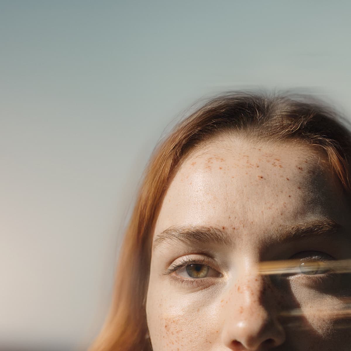 Close-up of a person's eyes and forehead with freckles, partially shaded, against a blurred sky background.