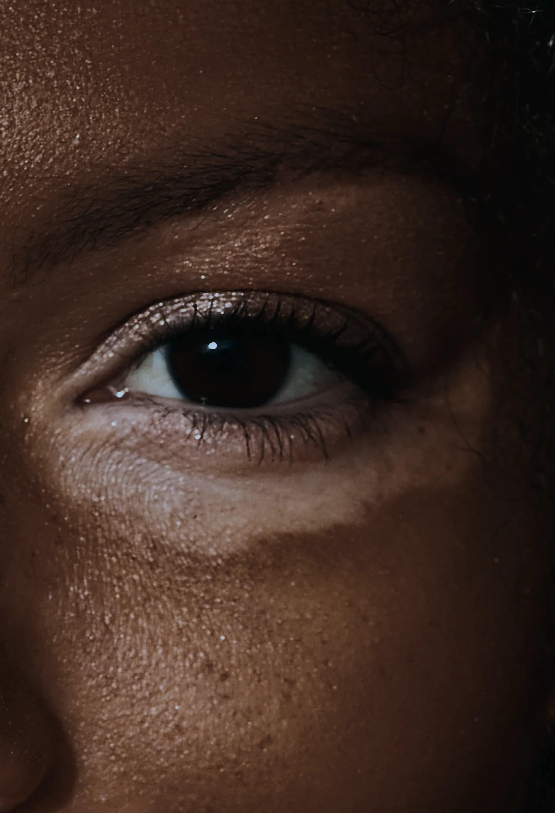 Close-up of a person's eye with smooth skin and a distinct pigmentation pattern around the eye area.